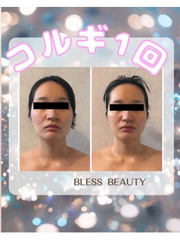 ブレスビューティー(BLESS BEAUTY)の写真/【メディアで話題の華奢みえコルギ】『小顔』に特化した業界注目の技術！二重顎・エラ・左右差・むくみに！