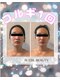ブレスビューティー(BLESS BEAUTY)の写真/【メディアで話題の華奢みえコルギ】『小顔』に特化した業界注目の技術！二重顎・エラ・左右差・むくみに！