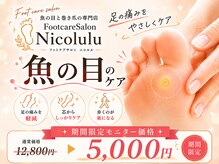 魚の目と巻き爪の専門店　フットケアサロン Nicolulu 大阪天満店【ニコルル】の雰囲気（魚の目ケアだけではなく繰り返さない為のケアとアドバイスが自慢）