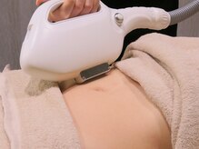 ミミ(mimi)/【お腹脱毛】施術イメージ