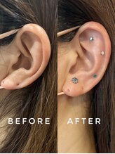 シロ(silo.)/耳つぼ