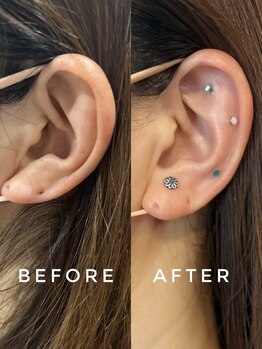 シロ(silo.)/耳つぼ