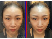 セブンシーズ 上野店(Seven Seas)/重力に負けない素肌育成の技術！