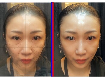 セブンシーズ 上野店(Seven Seas)/重力に負けない素肌育成の技術！