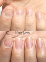 マリーロール 梅田店(Marie Laure)/自爪育成/深爪矯正/ネイルケア