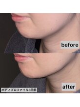 アクティブエイジング 金沢新竪町店/エンビロン　ボディプロファイル