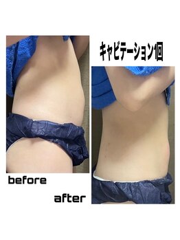 サロンAQ 昭和店/痩身