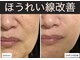 クレリア(clelia)の写真