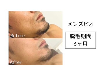 メンズビオ 神戸三宮店/