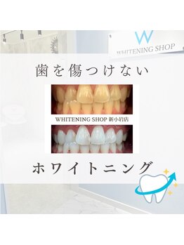 ホワイトニングショップ 新小岩店/
