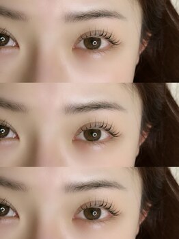 3104の写真/初めての方も◎丁寧なカウンセリングと高い技術力で理想の目元へ！悩んでたお目元がチャームポイントに☆