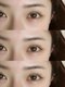 3104の写真/初めての方も◎丁寧なカウンセリングと高い技術力で理想の目元へ！悩んでたお目元がチャームポイントに☆