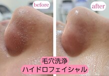 ワックス脱毛サロン アルスタ(ALUSTA)