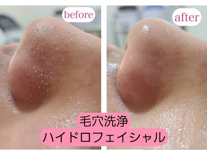 ワックス脱毛サロン アルスタ(ALUSTA)の写真