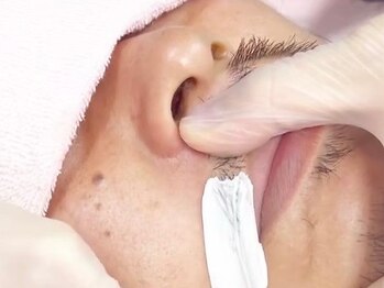 ジェンティル(Gentil)の写真/痛みを抑えた眠れるワックス！完全個室サロンでお肌をケアしながらワックス脱毛♪清潔感UP◎