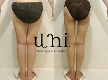 ユニ(uni.)の雰囲気(結果重視の【オーダーメイド痩身】あなたの理想の姿に導きます)