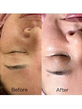 シロ(siro)/韓国水光肌・美白フェイスWax