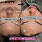 オーパス ビューティー(OPUS Beauty)
