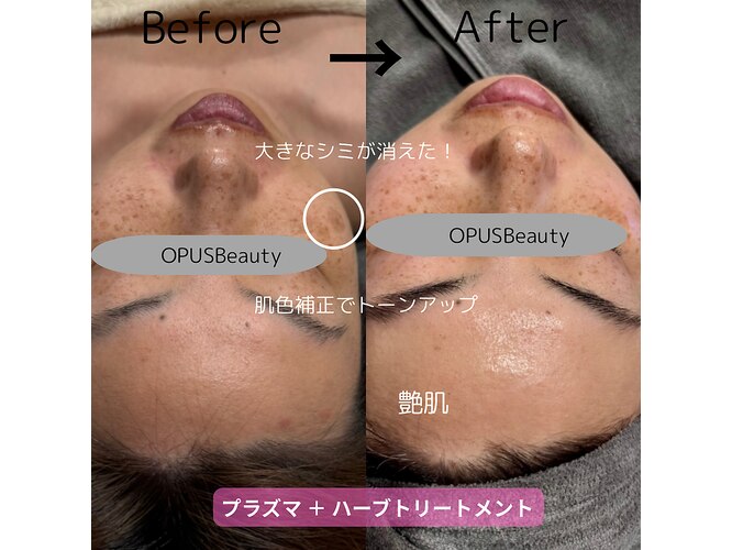 オーパス ビューティー(OPUS Beauty)｜ホットペッパービューティー