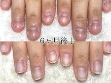 グラシナ 鳥丸店/(深爪/長さだし/フィルイン/)