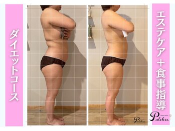 プルクレ 常磐町店(Pulchre)/ダイエットコース♪