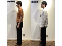 コルミチョン サロン(骨美整 salon)/メンズ　姿勢　Before・After 