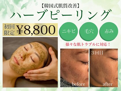 エステサロン ソワンの写真