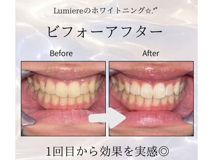 ルミエール 名古屋(Lumiere)の写真