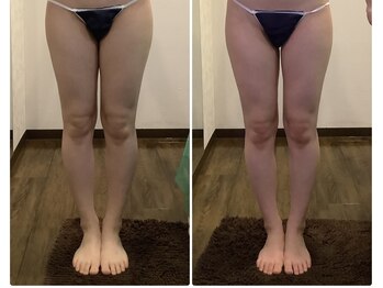 エステティックジュネス(JEUNESSE)/シークレットボディ