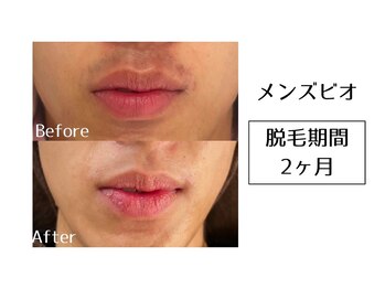 メンズビオ 神戸三宮店/