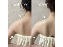 ウンスイスパ(UNSUI SPA)/ブライダルエステも人気！