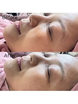 シロ(siro)/韓国水光肌・美白フェイスWax