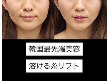 メディカルエステ ユウ(Yuu)