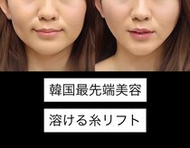 メディカルエステ ユウ(Yuu)