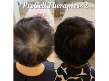 【before⇒after】本気の頭皮環境改善！プロセルセラピーズ★