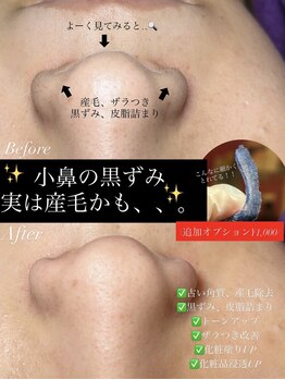 ジョエルワックス 沖縄那覇店(JOELLE WAX)/鼻の黒ずみ産毛、古い角質除去★