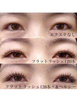 フランキンセンス 香取佐原店/なし→120本→＆ヘルシー