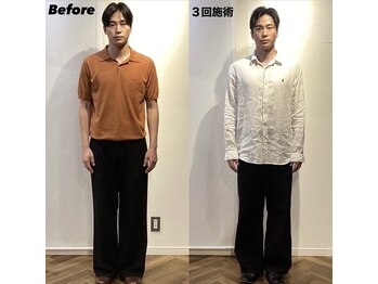 コルミチョン サロン(骨美整 salon)/メンズ　姿勢　Before・After 