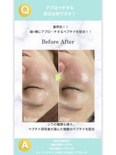 エステサロン アンジュール(Angelle)/どんな成分が入ってるの？