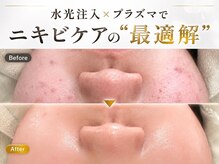 i'm este 平塚店【肌管理×小顔/毛穴改善フェイシャルサロン】-小顔/毛穴/シミケア-の雰囲気（小顔/毛穴洗浄/毛穴/フェイシャル/シミケア/ニキビケア/平塚）
