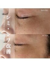 ヴィヴィアン 太田川店(Vivian)/シミ・シワ改善！最強の肌顔を！