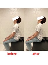ナオル整体 福岡香椎院(NAORU整体)/30代男性施術事例【首肩こり】