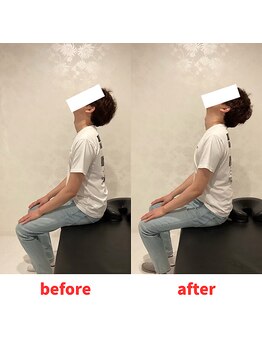 ナオル整体 福岡香椎院(NAORU整体)/30代男性施術事例【首肩こり】