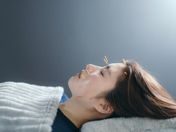 コンディショニングラボ いわくら治療院(Conditioning Labo)の写真/【美容鍼5200円】シミ/くすみが気になる方に,深層から再構築◇肩こり/腰痛には体の鍼灸とのsetもおすすめ＊