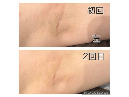 レイモード(Ray mode)の写真