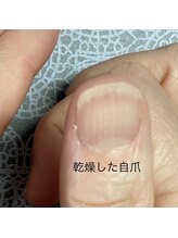 桃の木 吉祥寺店/乾燥して傷んだ爪は戻りません