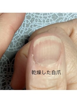 桃の木 吉祥寺店/乾燥して傷んだ爪は戻りません