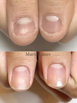 マリーロール 梅田店(Marie Laure)/自爪育成/深爪矯正/ネイルケア