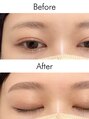 アイム 福山店(i’m) 【Before→After】