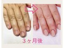 3ヶ月後には縦長爪！